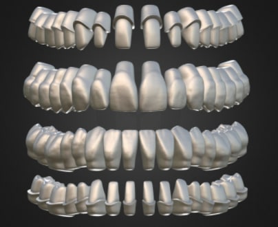 Teeth Model
