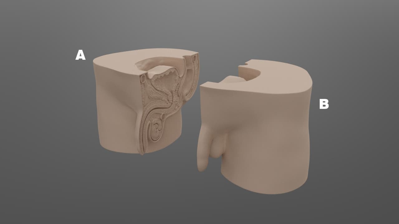 Male Genital