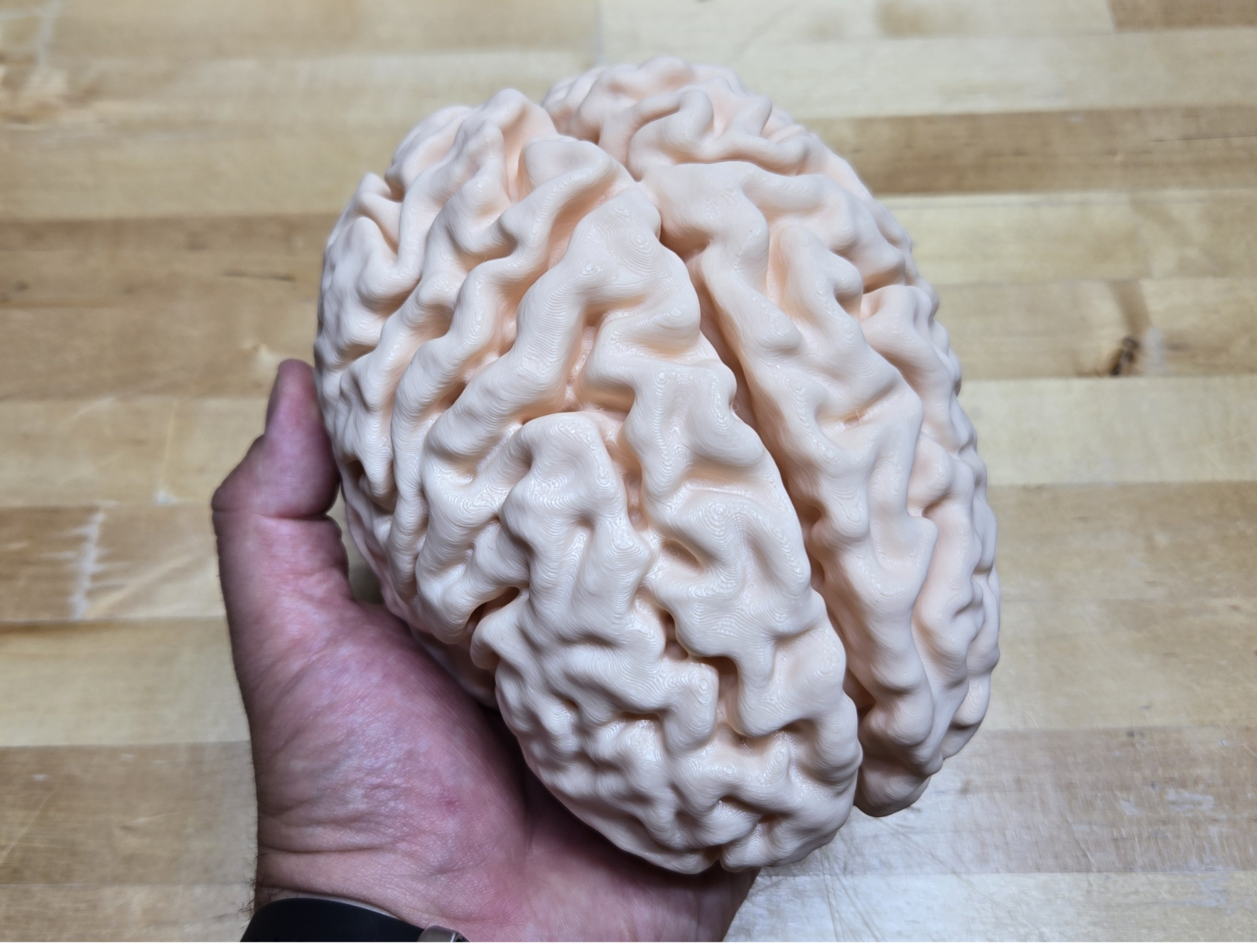 Cerebro Humano por Ressonancia